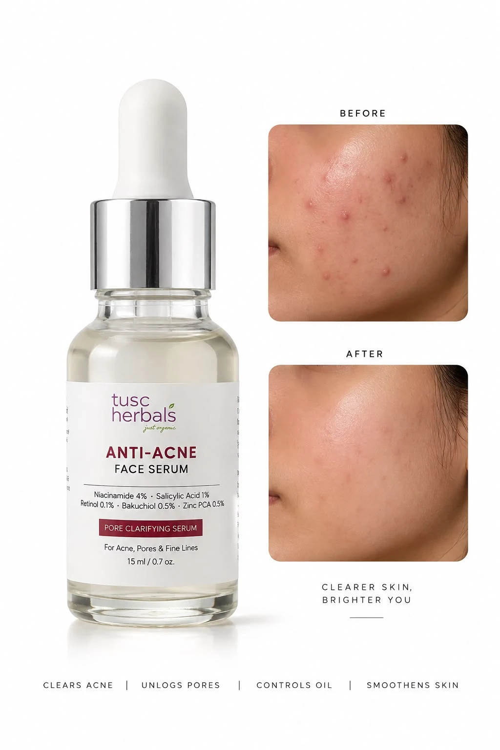 Acne Clear Firming Serum - Image 3